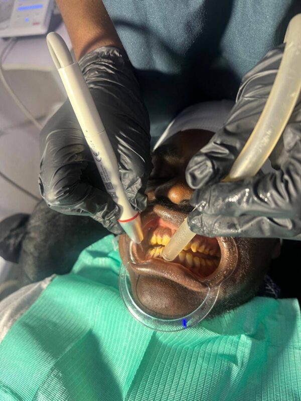 Teeth Whitening in Buea Cameroon Teeth Whitening in Buea Cameroon