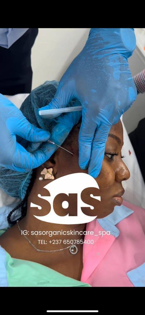 body Fillers in Buea Cameroon body Fillers in Buea Cameroon