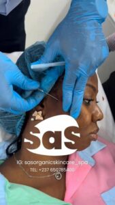 facial profiling